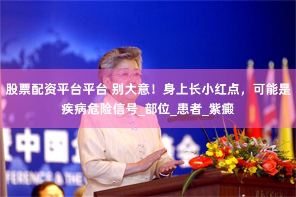 股票配资平台平台 别大意！身上长小红点，可能是疾病危险信号_部位_患者_紫癜